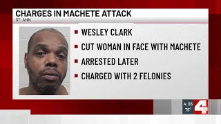 Man accused of attacking woman with machete in St. Ann