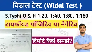 Widal Test in Hindi | टाइफाइड पॉजिटिव या नेगेटिव | Widal Test Report कैसे समझे@MLTLabManual2.0