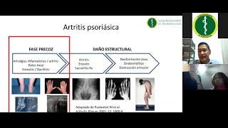 Simposio de Artritis Psoriásica