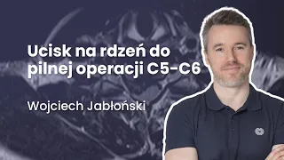 Ucisk na rdzeń do pilnej operacji C5-C6 | #43 Radiologia