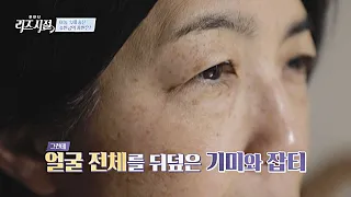 기미와 잡티로 뒤덮인 피부.. 어둠 속에 숨은 주인공의 사연은? | 한 번 더 리즈시절 85회 | JTBC 240520 방송