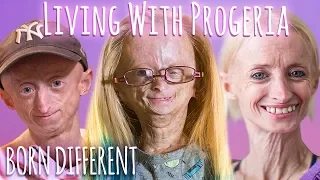 Living With Progeria (30 Min Documentary) | BORN DIFFERENT