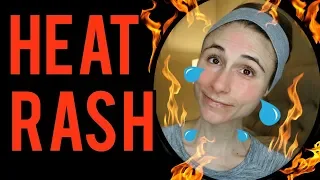 Dermatologist's tips for heat rash: Dr Dray 🔥🔥