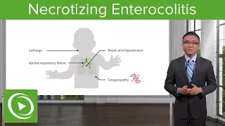 Necrotizing Enterocolitis – Surgery | Lecturio