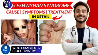 lesch nyhan syndrome biochemistry | symptom of lesch nyhan syndrome | purine salvage pathway