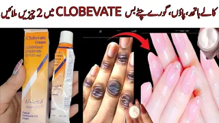 Add 2 Things In Clobevate Cream | clobevate farmula For Hand Foot Whetieng | Skin Whetieng Cream