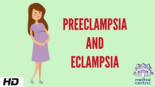 Preeclampsia and Eclampsia, Causes, Signs and Symptoms, Diagnosis and Treatment.