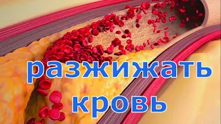 Как разжижать кровь Простые доступные способы.