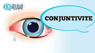 CONJUNTIVITE: QUANDO SUSPEITAR? TIPOS? QUAL A GRAVIDADE?