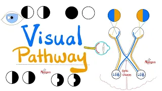 Visual Pathway & its defects - Optic nerve - Optic Chiasm - Optic tract - Lateral Geniculate Body