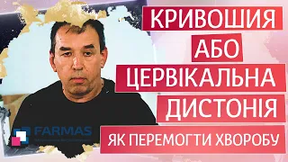 Кривошия або цервікальна дистонія. Як перемогти хворобу