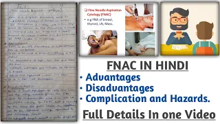 FNAC | fine needle aspiration cytology