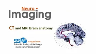 Radiological anatomy of Brain (DRE) Prof. Mamdouh Mahfouz