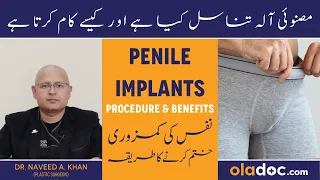Nafs Ki Kamzori Ka Ilaj - Penile Implant Procedure & Benefits - Azu Tanasul Ka Thik Karne Ka Tarika
