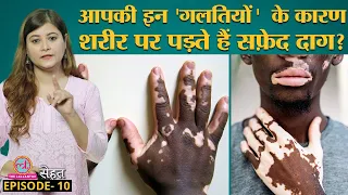 शरीर पर सफ़ेद दाग पड़ने वाली बीमारी Vitiligo क्या ठीक हो सकती है? Sehat Ep 10