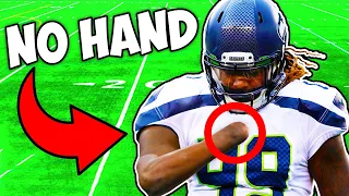 THIS NFL PLAYER ONLY HAS ONE HAND..