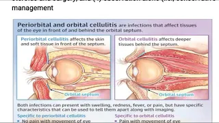 Orbital cellulitis in Hindi #periorbitalcellulitis #orbitalinfection