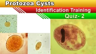 Protozoa Cysts Identification Training  Quiz ( Part 2 )