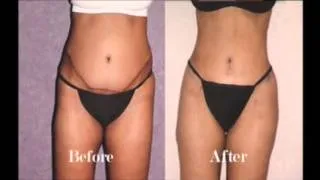 Dr. Patronella's Corrective Plastic Surgery Procedures Before & After Photos