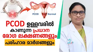 PCOD ഉള്ളവരിൽ കാണുന്ന  രോഗ ലക്ഷണങ്ങളും പരിഹാര മാർഗങ്ങളും | PCOD Symptoms in Malayalam