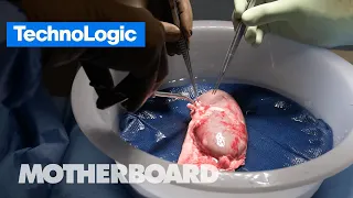 Transplanting Pig Organs into Humans | TechnoLogic