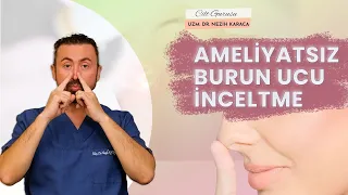 Ameliyatsız Burun İnceltmek mümkün mü? Ameliyatsız Burun Ucu İnceltme Yöntemi