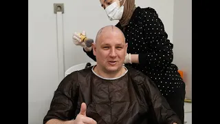 пересадка волос в турции 2022 | Dr. Bayer Clinics: Пересадка волос в Турции  🇹🇷