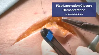 Flap Laceration Closure Demonstration | The Cadaver-Based Suturing Self‑Study Course