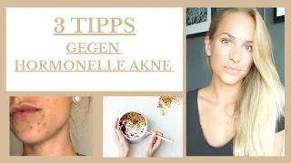 3 Tipps gegen hormonelle Akne! Ganzheitliche Hautpflege