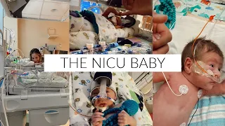 The NICU | our story, c-section scar, $ cost, insane stories, & worst moments