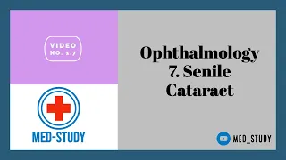 Ophthalmology : 7.Senile Cataract