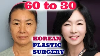 MY MOM DID PLASTIC SURGERY IN KOREA! | Sunnydahye