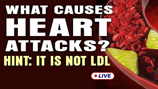 What Causes Heart Attacks? Hint: It Is Not LDL (LIVE)