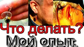 Тройник в теле, что делать? Личный опыт, для тех кто любит рыбалку.