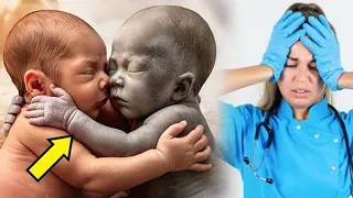 A nurse places a healthy child next to a dying one and then the incredible happens!