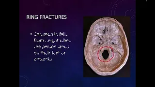 Brain Trauma and Skull Fractures Part 2