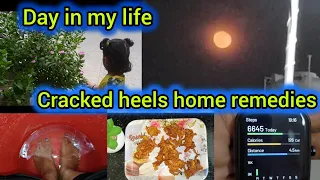 Day in my life Tamil|home remedies for cracked heels#vlog#dayinmylife#tamil##youtubevideo#trends