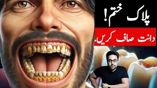 Dr. Zee:Top Remedy To get rid of Dental Plaque (TARTAR) | डॉक्टर ज़ी