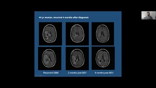 Grand Rounds. The Shifting Landscape of Clinical Neuro-oncology. Dr. Mohile. 11/12/21