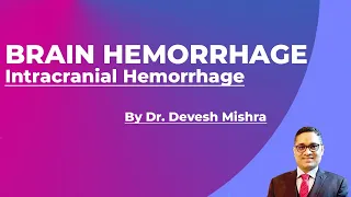 Brain Hemorrhage (Intracranial Hemorrhage) types....