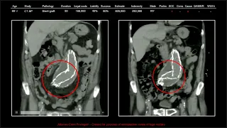 137 Years of Medical Malpractice Part 8 of 9 | Free Radiology CME