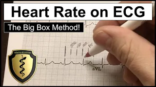 ECG Heart Rate Calculation - The Big Box Method (AKA the 300 Method)