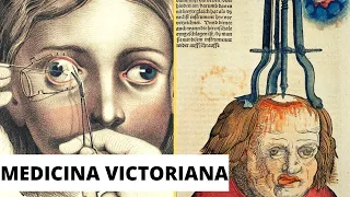 7 DANGEROUS MEDICAL PRACTICES OF THE VICTORIAN PERIOD.