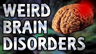 Five Weird Brain Disorders