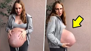 Descubra o que tinha na BARRIGA DESSA MULHER para ela ficar ASSIM!