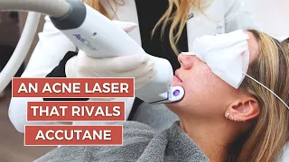 I Tried An Acne Laser That Rivals Accutane | What the Wellness | Well+Good