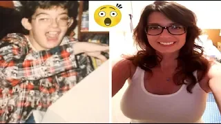 Top 10+ People Who Used To Be “Ugly Ducklings”  Share Their Transformations