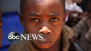 Madagascar donations pour in from ‘World News Tonight’ viewers l WNT