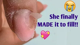 Anna Never Made it This FAR - 3 weeks, no broken nails! | Bitten Nails Fill