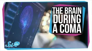 What Happens in the Brain During a Coma?